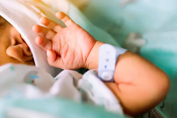 Recién nacido con pulsera hospitalaria tras parto con sufrimiento fetal, complicación que afecta al bebé por falta de oxígeno.