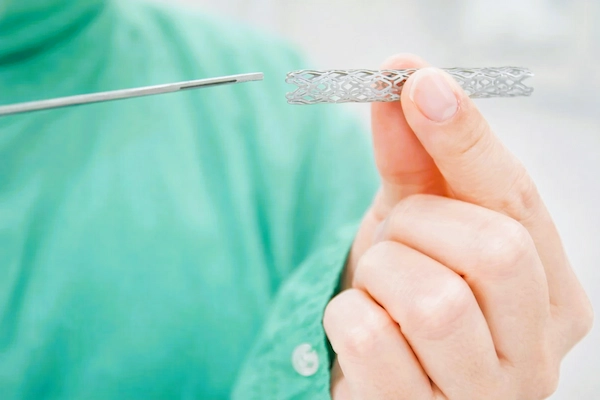 Stent coronario sostenido por médico, relacionado con negligencia por stent obstruido que bloquea una arteria.