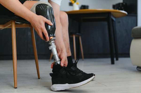 Persona con prótesis en la pierna ajustando su calzado, reflejo de amputaciones derivadas de negligencias médicas.